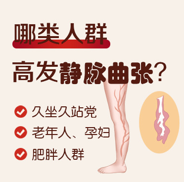静脉曲张