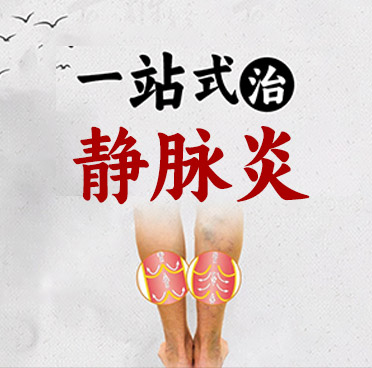 静脉炎